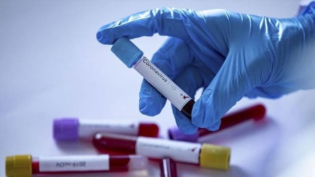 Koronavirusla bağlı SON STATİSTİKA