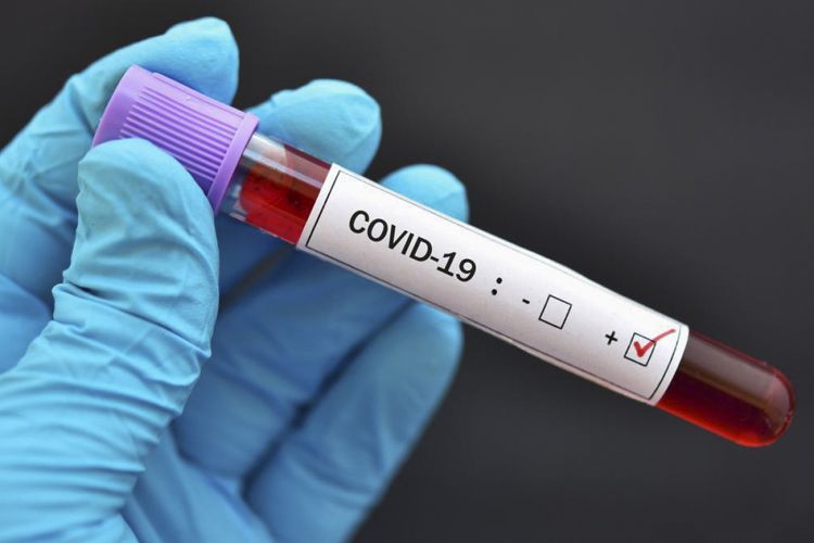 Gürcüstanda son sutkada COVID-19-dan 7 nəfər öldü