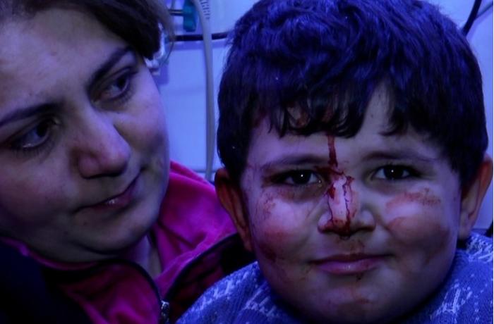 Müharibə uşaqların psixologiyasında ciddi travmalar yaradır - PSİXOLOQ
