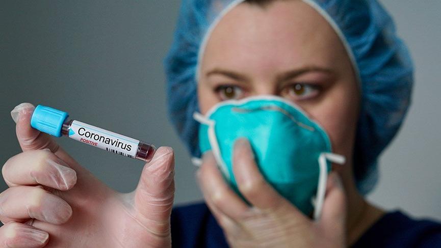 Moskvada daha 68 nəfər koronavirusdan öldü