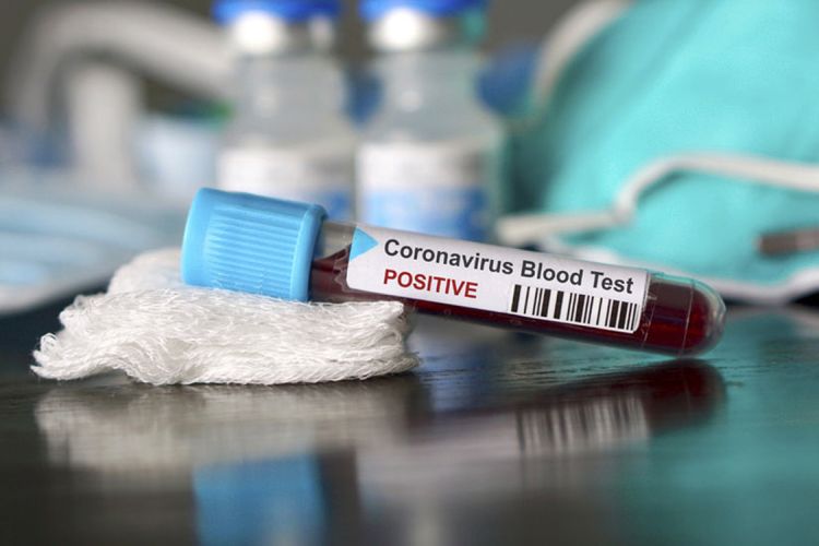 Azərbaycanda indiyədək aparılmış koronavirus testlərinin sayı açıqlandı