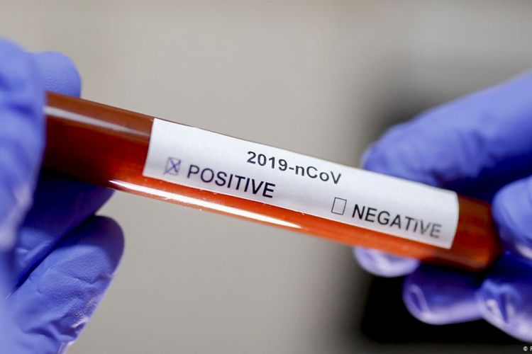 Evini tərk edən 29 koronavirus xəstəsi SAXLANILIB