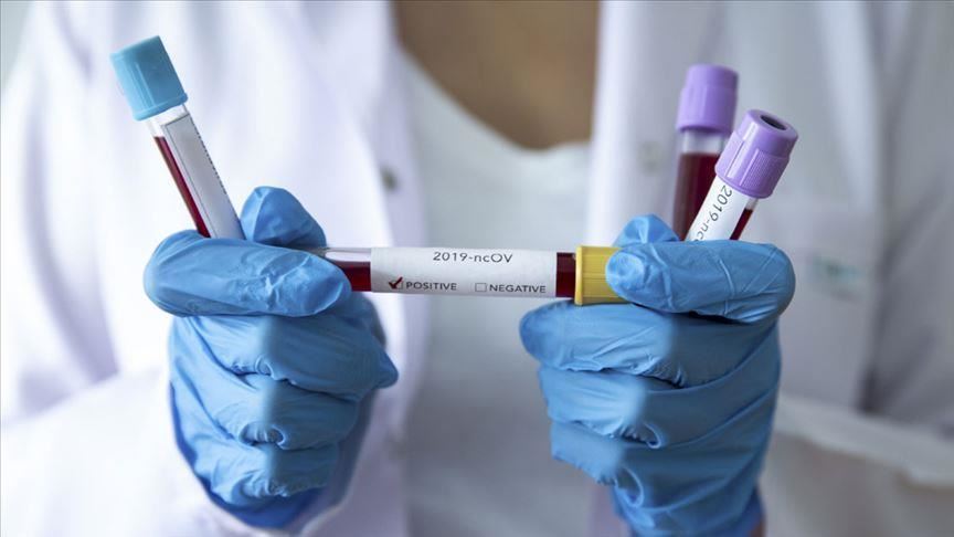 Dünyanın ən son koronavirus STATİSTİKASI
