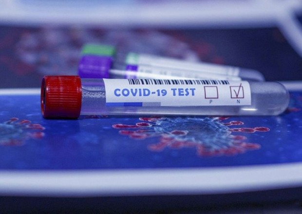 Rusiyada koronavirusdan ölənlərin sayı 58 mini ötüb