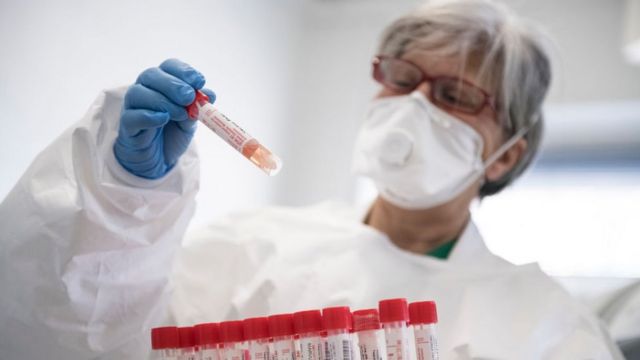 Rusiyada virusdan ölənlərin sayı azaldı