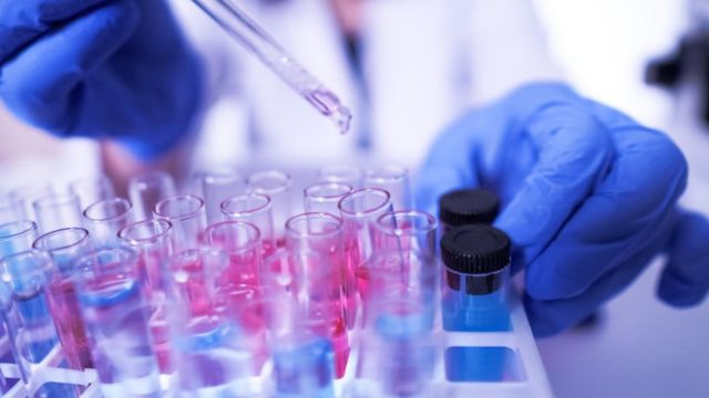 Bu ölkədə koronavirus testi verməyənlər HƏBS OLUNACAQ