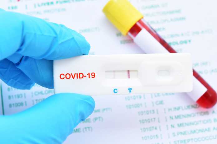 Almaniyada sürətli koronavirus testlərinin satışına başlanıldı