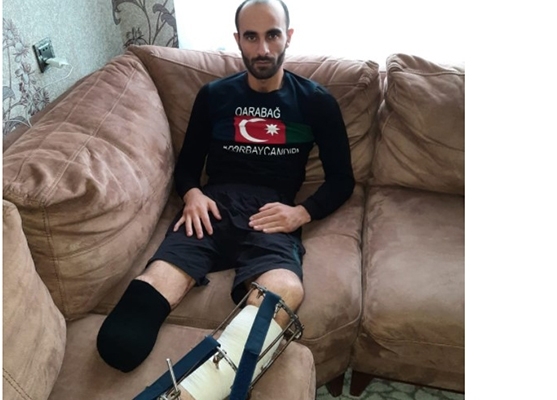 Hər iki ayağımı itirən qaziyə niyə 3-cü qrup əlillik verilib?