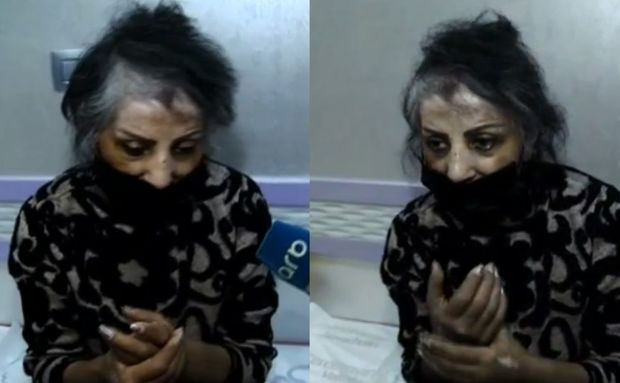 Əməkdar artist Zöhrə Abdullayeva xəstəxanaya yerləşdirildi
