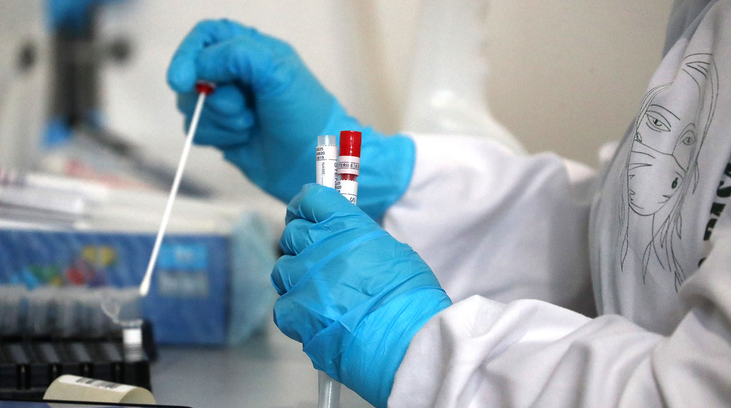 Daha 2 koronavirus xəstəsi SAXLANILDI