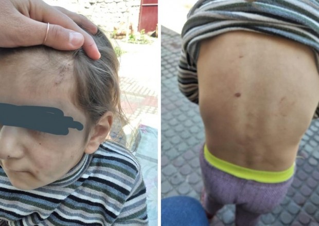 Dövlət Komitəsi azyaşlı qızın döyülməsilə bağlı araşdırmalara başladı