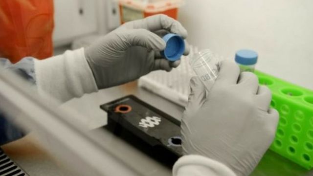 Azərbaycanda koronavirusa ən çox bu yaşda olanlar YOLUXUBLAR 