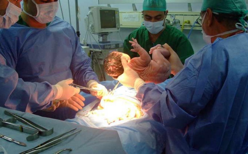 Bakıda əkizlər doğuş zamanı öldü