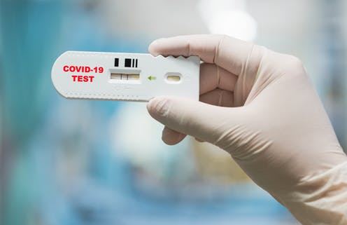 Jurnalistlər COVİD-19 testi verəcəklər