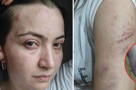 Polis şöbəsində qətlə yetirilən qadının qardaşı DANIŞDI
