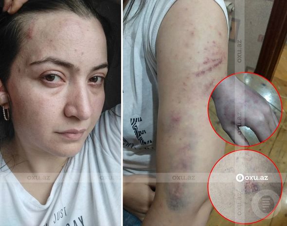 Öldürülən qadının uşaqları qəyyumluğa verildi - RƏSMİ