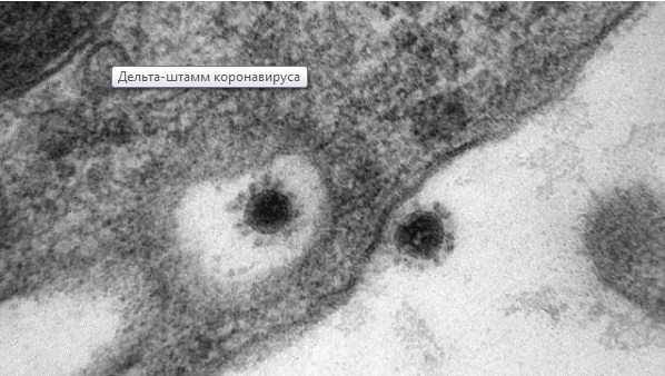 Koronavirusun delta ştammının FOTOSU