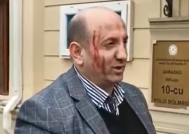“Sədərək”də yeni axunda etiraz edən şəxs HƏBS EDİLDİ
