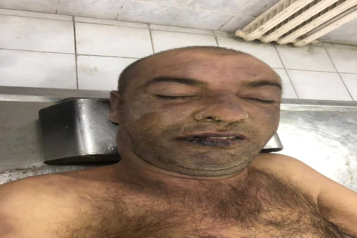 Xızıda naməlum kişi meyiti tapılıb - FOTO