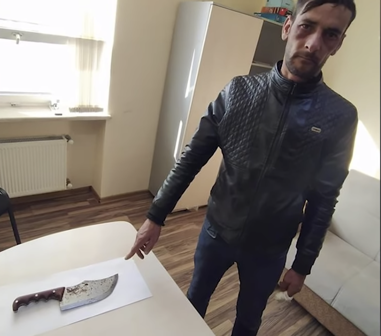 Qayınlarını həbs etdirmək üçün barmağını kəsdi - FOTO