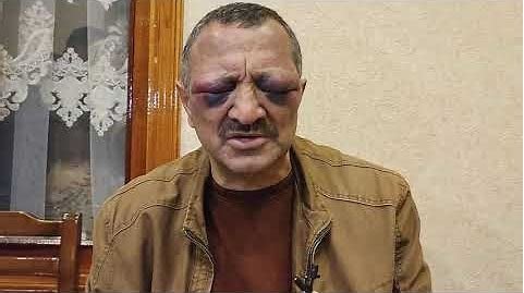 Tofiq Yaqublunun döyülməsi ilə bağlı araşdırma YEKUNLAŞDI