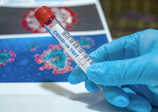 Rusiyada virusa yoluxma sayı 11 milyonu ötüb 