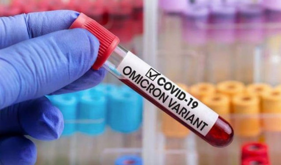Məşhur həkim “omicron”un sonu ilə bağlı proqnoz verdi