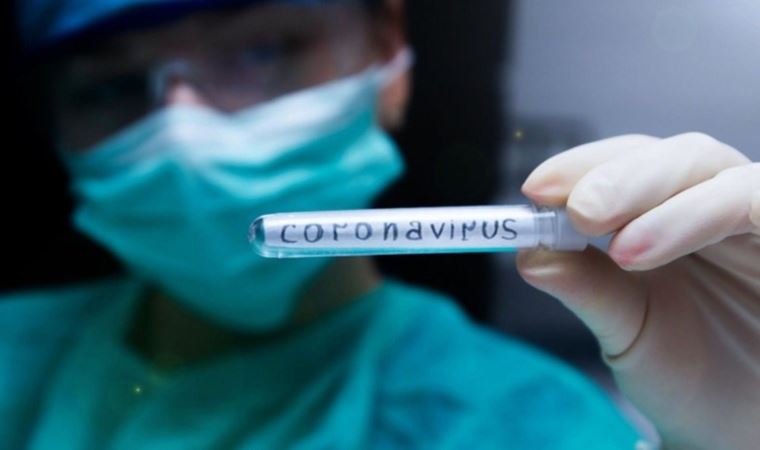 Ermənistanda daha 3536 nəfərdə virus aşkarlandı