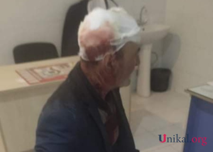 Gəncədə yaşlı kişini baltaladılar