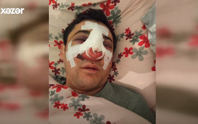 Bakıda avtobus sürücüsü döyüldü - Anbaan VİDEO
