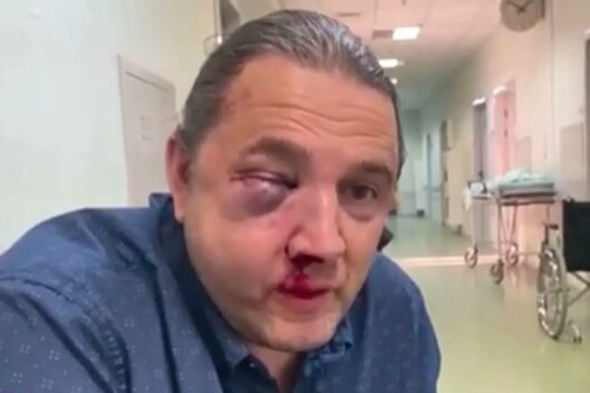 Keçmiş deputatı döyüb burnunu sındırdılar