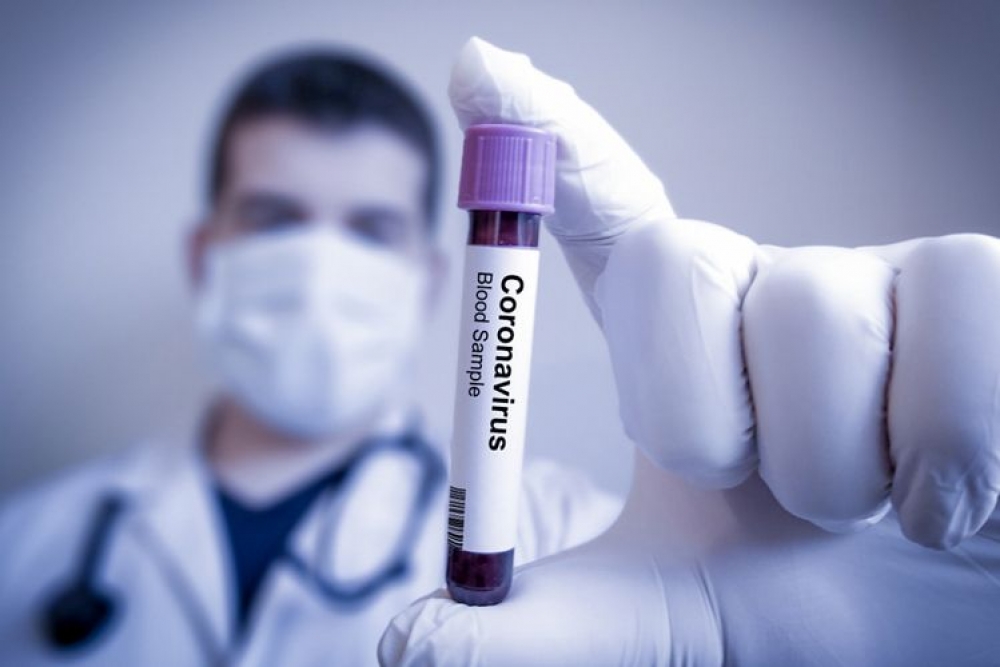 Rusiyanın koronavirus statistikası