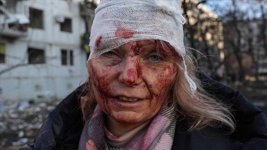 Rusiya-Ukrayna müharibəsinin simvolu: “Putinə təslim olmaqdansa, ölmək yaxşıdır” - Dünya ondan danışır
