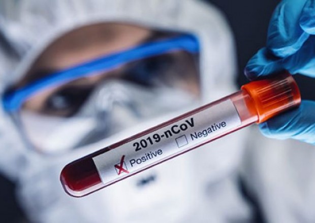 Dünyanın koronavirus mənzərəsi