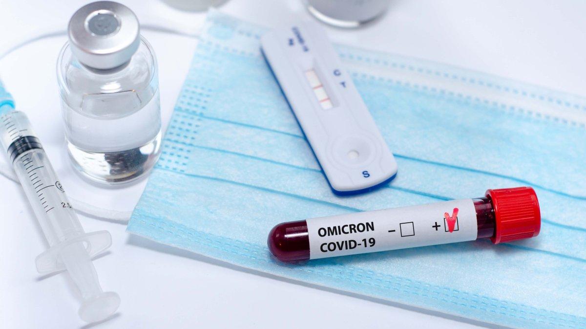 Yenə COVID-19-dan ölən olmayıb