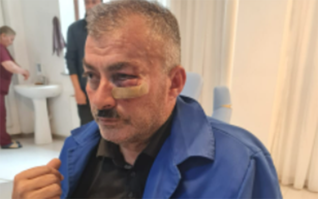 Borclu abonent “Azəriqaz”ın əməkdaşını döydü - FOTO