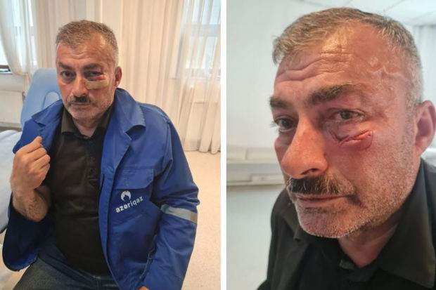 “Azəriqaz”ın əməkdaşını döyən şəxsə cinayət işi AÇILDI