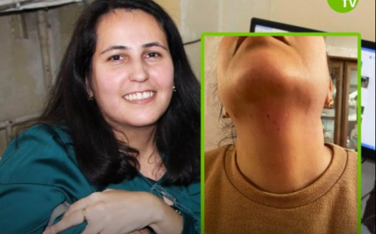 Bakıda jurnalistə hücum edildi - FOTO