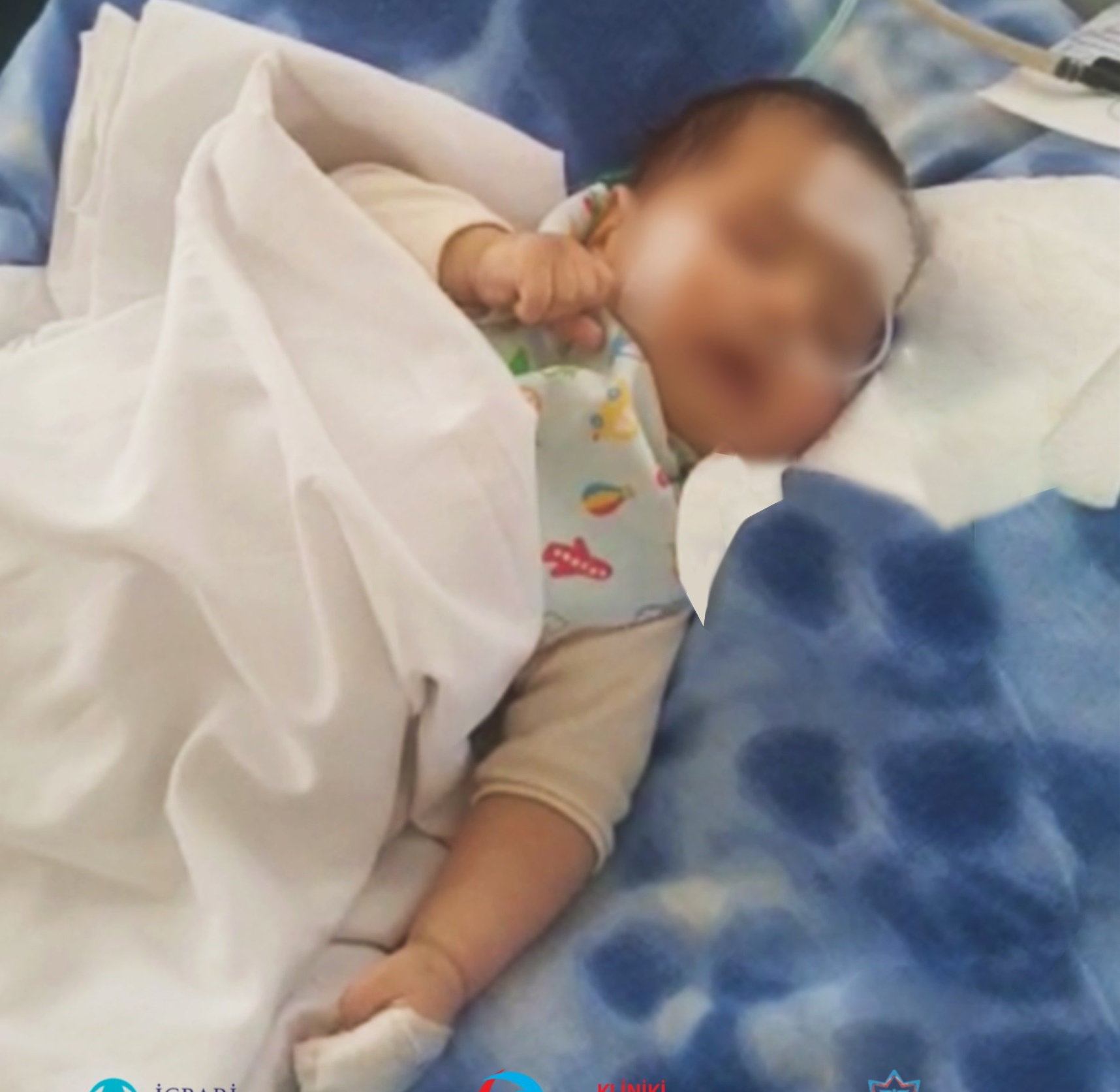 3 aylıq körpə ölümdən döndü