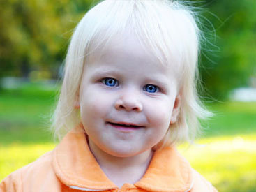 Azərbaycanda neçə albinos var?