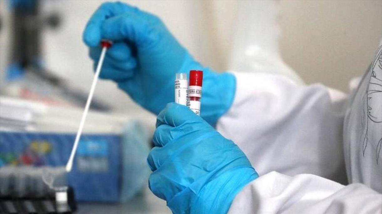 Gündəlik yoluxma statistikası insanlara maraqlı deyil - DEPUTAT