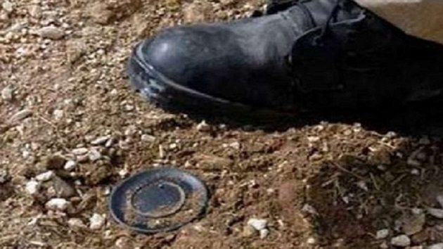 Minaya düşən polisin ayağı amputasiya edildi