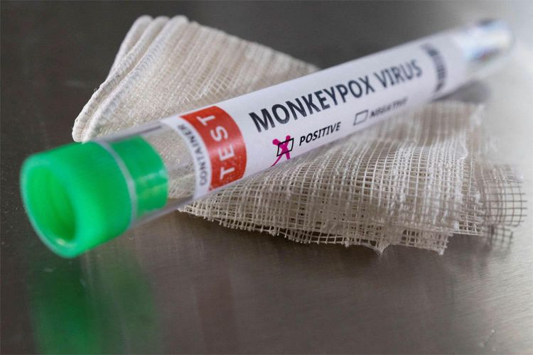 Bu ölkədə meymunçiçəyinə yoluxanların çoxu KİŞİLƏRDİR
