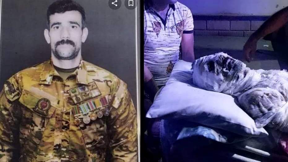 Özünü yandıran qazi VƏFAT ETDİ