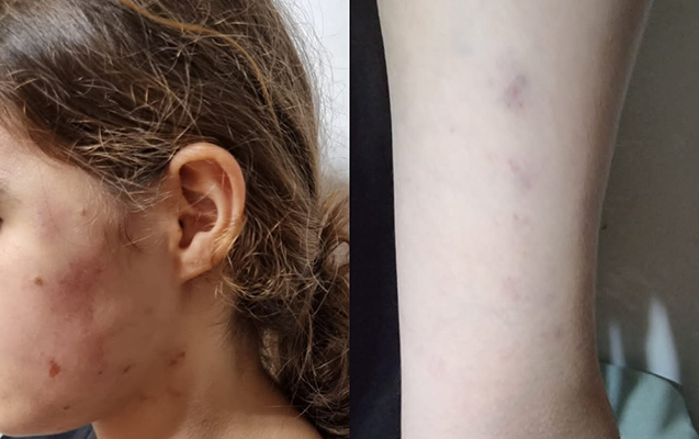 Lənkəranda məktəbli qız başçının müavini tərəfindən döyülüb? - RƏSMİ CAVAB