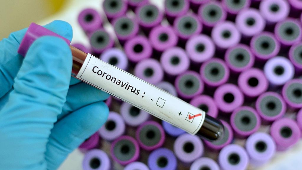 COVID-lə bağlı rəqəmlər düzgün deyil - Həkimdən qalmaqallı AÇIQLAMA