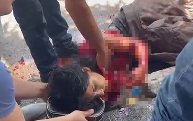 Sevgilisi tərəfindən bıçaqlanan qız öldü