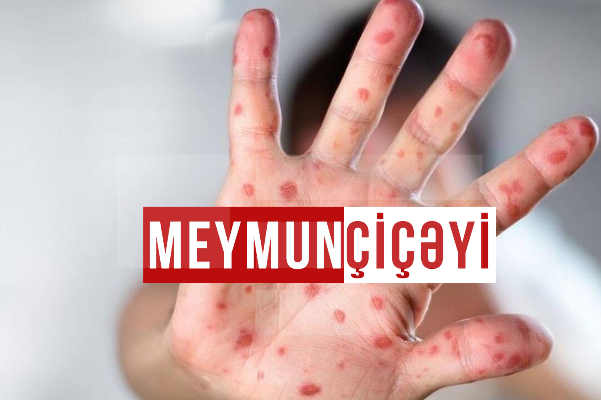 Meymunçiçəyinə görə fövqəladə vəziyyət elan olundu