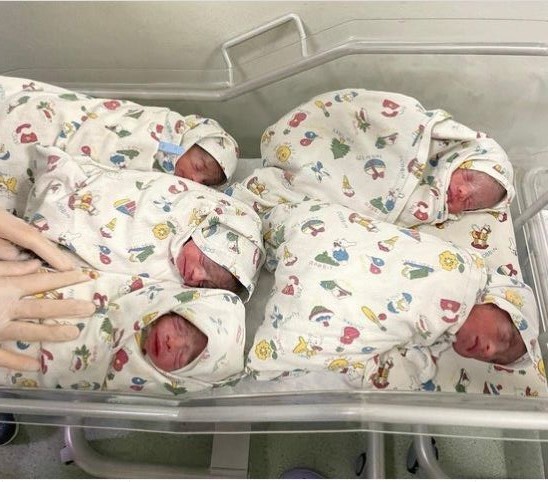 Bakıda doğulan beşəmlərdən biri öldü