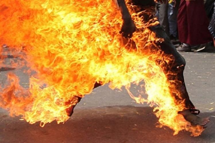 Daha bir qazi özünü yandırdı - Vəziyyəti ağırdır